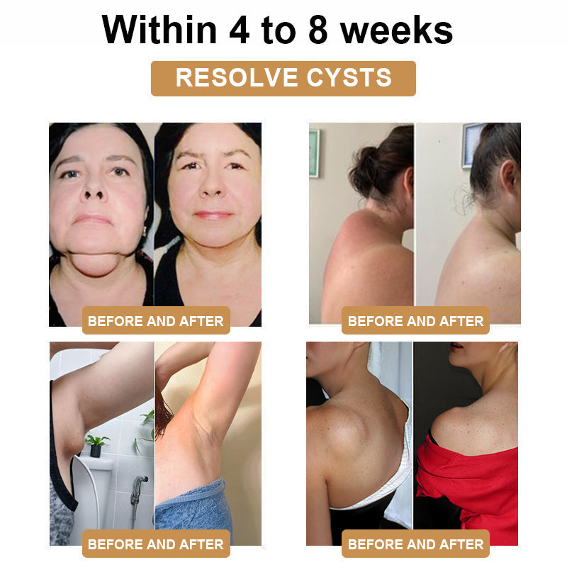 ⚡SCNDR™𝗨𝗹𝘁𝗿𝗮𝘀𝗼𝗻𝗶𝗰 𝗙𝗮𝘁 𝗕𝗹𝗮𝘀𝘁𝗶𝗻𝗴 𝗮𝗻𝗱 𝗗𝗲𝘁𝗼𝘅𝗶𝗻𝗴 𝗪𝗿𝗶𝘀𝘁𝗯𝗮𝗻𝗱 - Energy Balance 🎁 (Limited Time Discount + Doctor Recommended)🔥🔥🔥