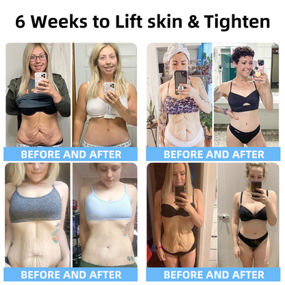 🔥👩‍⚕️𝐋𝐚𝐬𝐭 𝐃𝐚𝐲 𝐃𝐢𝐬𝐜𝐨𝐮𝐧𝐭: 𝟕5% 𝐎𝐅𝐅✨𝑺𝑷𝒁𝑽™ 𝑺𝒌𝒊𝒏 𝑳𝒊𝒇𝒕𝒊𝒏𝒈 𝑾𝒓𝒊𝒏𝒌𝒍𝒆 𝑹𝒆𝒎𝒐𝒗𝒂𝒍 𝑪𝒓𝒆𝒂𝒎 : Restore Skin Elasticity