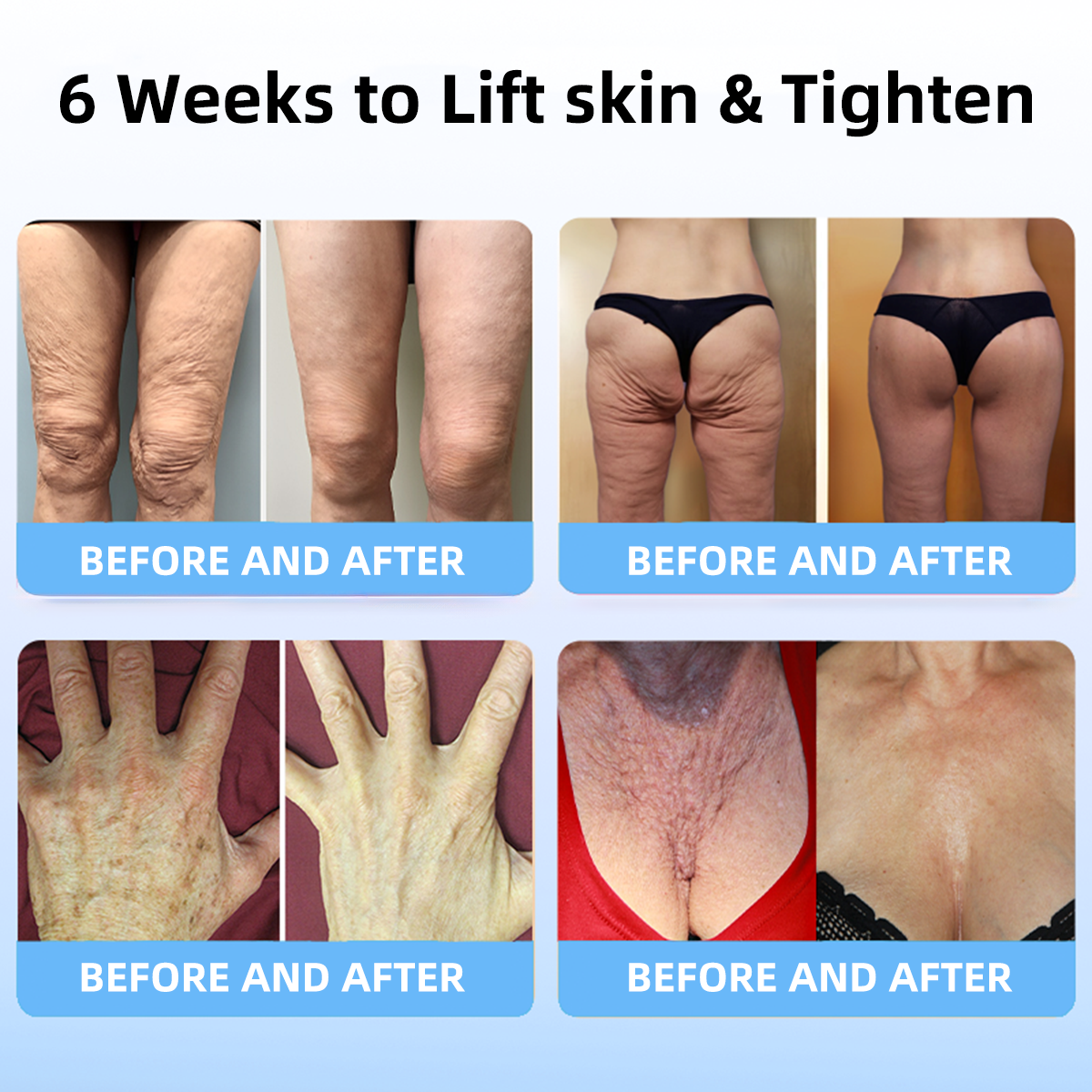 🔥👩‍⚕️𝐋𝐚𝐬𝐭 𝐃𝐚𝐲 𝐃𝐢𝐬𝐜𝐨𝐮𝐧𝐭: 𝟕5% 𝐎𝐅𝐅✨𝑺𝑷𝒁𝑽™ 𝑺𝒌𝒊𝒏 𝑳𝒊𝒇𝒕𝒊𝒏𝒈 𝑾𝒓𝒊𝒏𝒌𝒍𝒆 𝑹𝒆𝒎𝒐𝒗𝒂𝒍 𝑪𝒓𝒆𝒂𝒎 : Restore Skin Elasticity