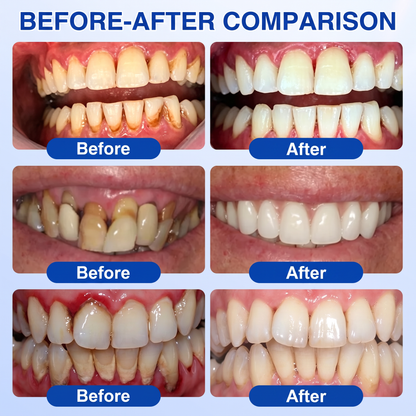 Glimmerly® GumRevive periodontal repair gel✨