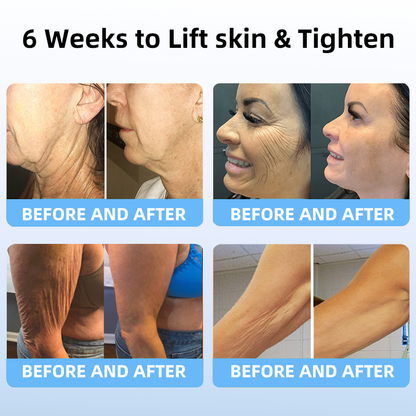🔥👩‍⚕️𝐋𝐚𝐬𝐭 𝐃𝐚𝐲 𝐃𝐢𝐬𝐜𝐨𝐮𝐧𝐭: 𝟕5% 𝐎𝐅𝐅✨𝑭𝒖𝒃𝒔𝒕𝒂® 𝑨𝒅𝒗𝒂𝒏𝒄𝒆𝒅 𝑭𝒊𝒓𝒎𝒊𝒏𝒈 & 𝑾𝒓𝒊𝒏𝒌𝒍𝒆-𝑹𝒆𝒅𝒖𝒄𝒊𝒏𝒈 𝑪𝒓𝒆𝒂𝒎 : Restore Skin Elasticity