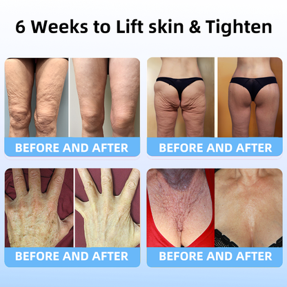 🔥👩‍⚕️𝐋𝐚𝐬𝐭 𝐃𝐚𝐲 𝐃𝐢𝐬𝐜𝐨𝐮𝐧𝐭: 𝟕5% 𝐎𝐅𝐅✨𝑭𝒖𝒃𝒔𝒕𝒂® 𝑨𝒅𝒗𝒂𝒏𝒄𝒆𝒅 𝑭𝒊𝒓𝒎𝒊𝒏𝒈 & 𝑾𝒓𝒊𝒏𝒌𝒍𝒆-𝑹𝒆𝒅𝒖𝒄𝒊𝒏𝒈 𝑪𝒓𝒆𝒂𝒎 : Restore Skin Elasticity