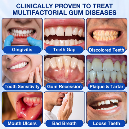 Glimmerly® GumRevive periodontal repair gel✨
