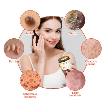 𝑻𝒖𝒓𝒐𝒏𝒖™  Bee Venom Wart & Tag Removal Cream( skin types) promotion 60% off)Suitable for allLast day🦅