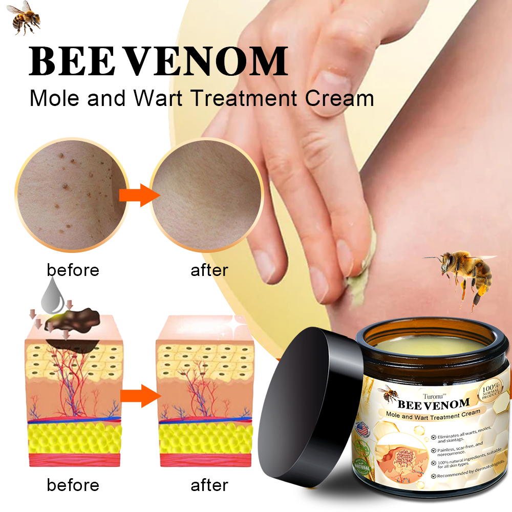 🕊️𝑻𝒖𝒓𝒐𝒏𝒖™  Bee Venom Wart & Tag Removal Cream( skin types) promotion 60% off)Suitable for allLast day