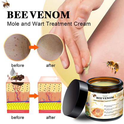 🕊️𝑻𝒖𝒓𝒐𝒏𝒖™  Bee Venom Wart & Tag Removal Cream( skin types) promotion 60% off)Suitable for allLast day