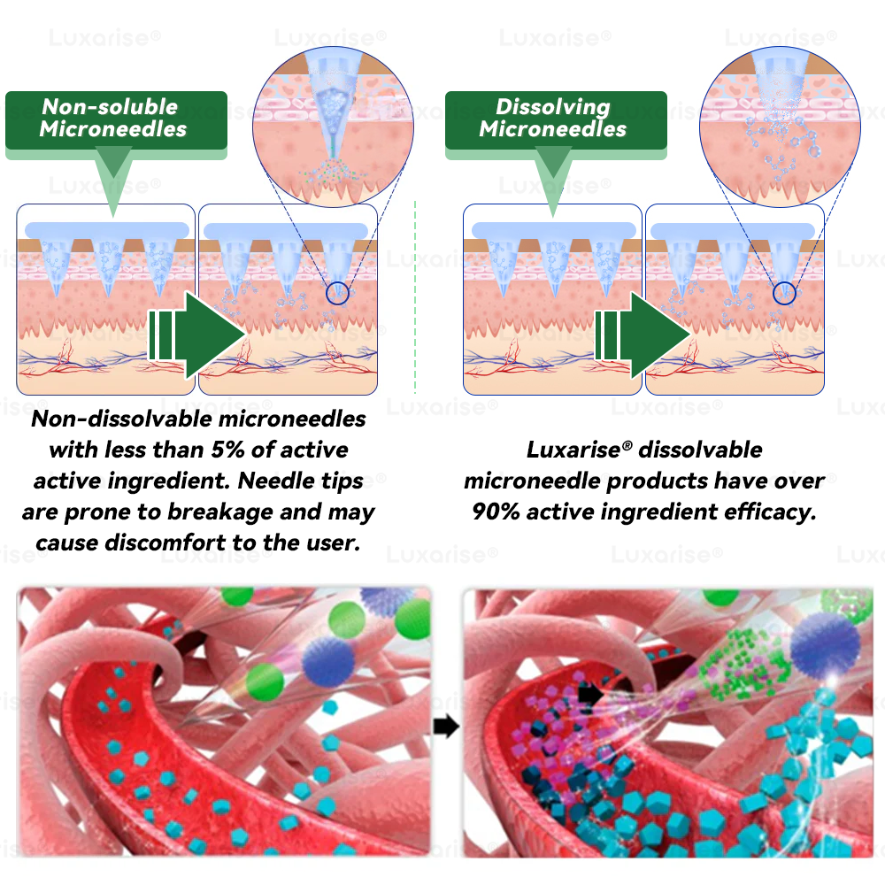 Once Daily, Visible Changes in 7 Days 👀 𝑳𝒖𝒙𝒂𝒓𝒊𝒔𝒆® 𝑴𝒐𝒓𝒊𝒏𝒈𝒂 & 𝑩𝒆𝒓𝒃𝒆𝒓𝒊𝒏𝒆 10-𝑰𝑵-1 𝑨𝒅𝒗𝒂𝒏𝒄𝒆𝒅 𝑵𝒂𝒏𝒐 𝑴𝒊𝒄𝒓𝒐𝒏𝒆𝒆𝒅𝒍𝒆 𝑷𝒂𝒕𝒄𝒉 𝐎𝐛𝐞𝐬𝐢𝐭𝐲, 𝐃𝐢𝐚𝐛𝐞𝐭𝐞𝐬, 𝐒𝐥𝐞𝐞𝐩 𝐀𝐩𝐧𝐞𝐚, 𝐀𝐧𝐝 𝐉𝐨𝐢𝐧𝐭 𝐈𝐬𝐬𝐮𝐞𝐬