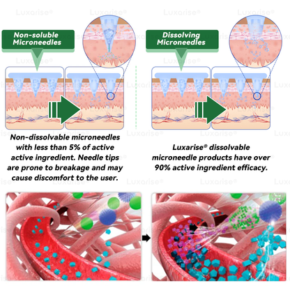 Once Daily, Visible Changes in 7 Days 👀 𝑳𝒖𝒙𝒂𝒓𝒊𝒔𝒆® 𝑴𝒐𝒓𝒊𝒏𝒈𝒂 & 𝑩𝒆𝒓𝒃𝒆𝒓𝒊𝒏𝒆 10-𝑰𝑵-1 𝑨𝒅𝒗𝒂𝒏𝒄𝒆𝒅 𝑵𝒂𝒏𝒐 𝑴𝒊𝒄𝒓𝒐𝒏𝒆𝒆𝒅𝒍𝒆 𝑷𝒂𝒕𝒄𝒉 𝐎𝐛𝐞𝐬𝐢𝐭𝐲, 𝐃𝐢𝐚𝐛𝐞𝐭𝐞𝐬, 𝐒𝐥𝐞𝐞𝐩 𝐀𝐩𝐧𝐞𝐚, 𝐀𝐧𝐝 𝐉𝐨𝐢𝐧𝐭 𝐈𝐬𝐬𝐮𝐞𝐬