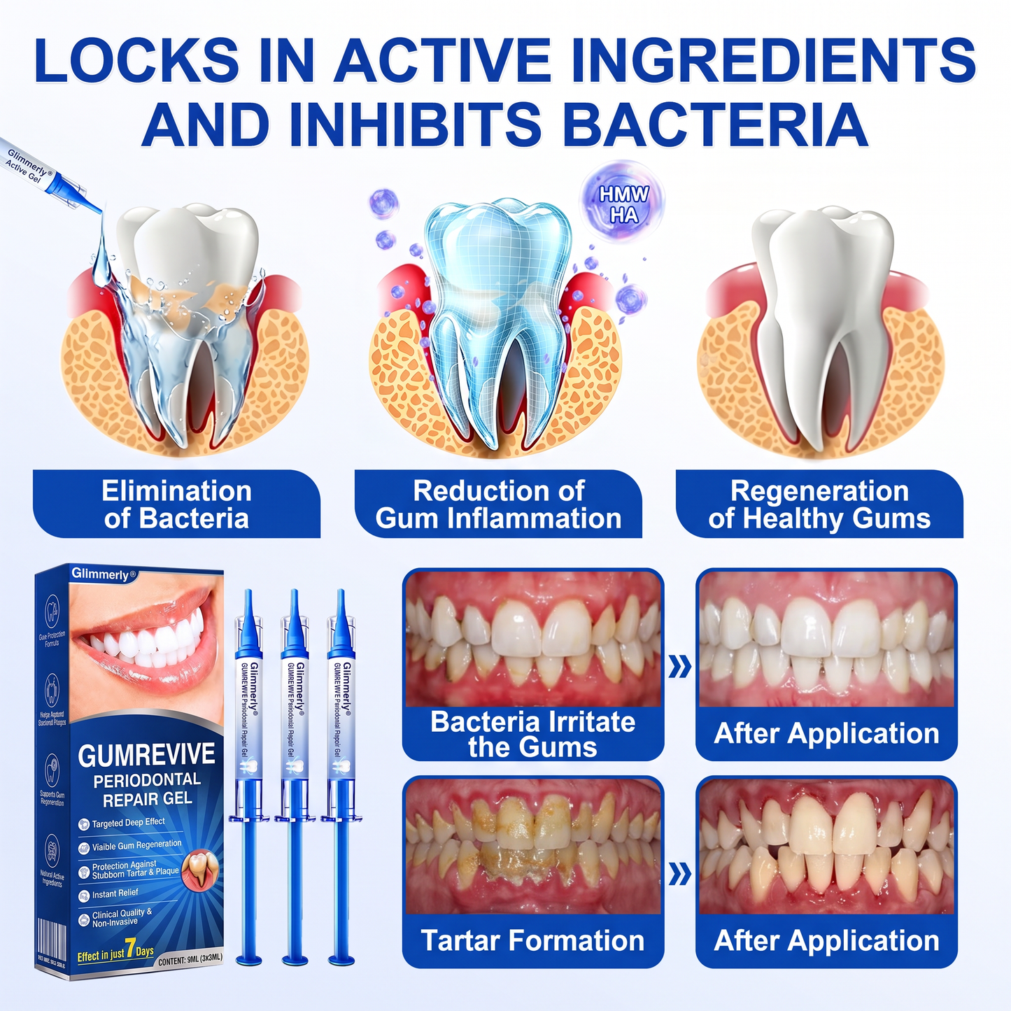 Glimmerly® GumRevive periodontal repair gel✨