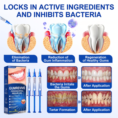 Glimmerly® GumRevive periodontal repair gel✨