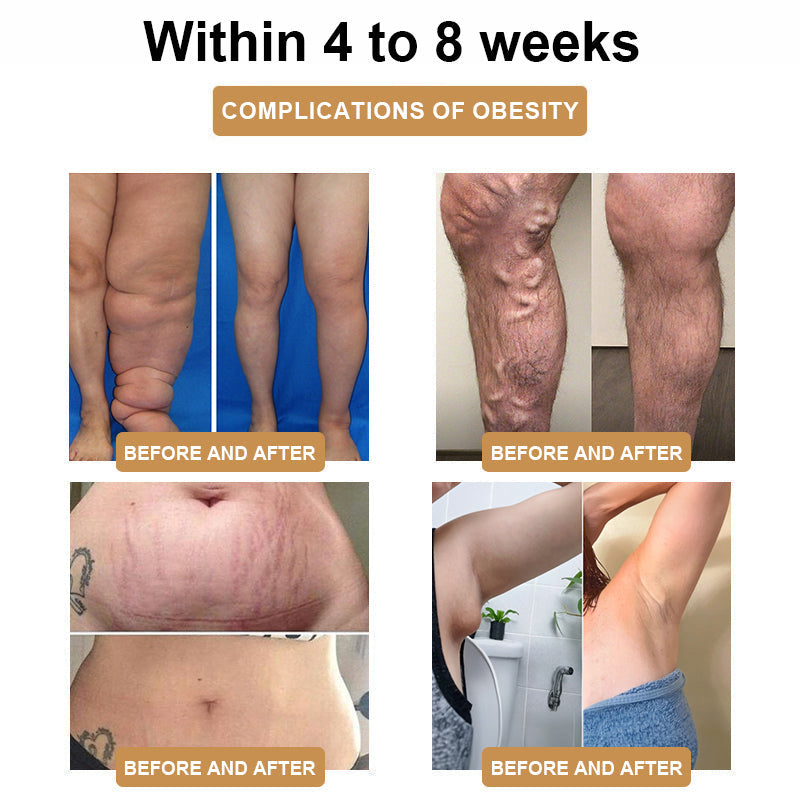 ⚡SCNDR™𝗨𝗹𝘁𝗿𝗮𝘀𝗼𝗻𝗶𝗰 𝗙𝗮𝘁 𝗕𝗹𝗮𝘀𝘁𝗶𝗻𝗴 𝗮𝗻𝗱 𝗗𝗲𝘁𝗼𝘅𝗶𝗻𝗴 𝗪𝗿𝗶𝘀𝘁𝗯𝗮𝗻𝗱 - Energy Balance 🎁 (Limited Time Discount + Doctor Recommended)