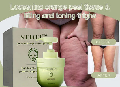 STDEI™  𝑳𝒖𝒙𝒖𝒓𝒊𝒐𝒖𝒔 𝑪𝒐𝒍𝒍𝒂𝒈𝒆𝒏 𝑭𝒊𝒓𝒎𝒊𝒏𝒈 𝑪𝒓𝒆𝒂𝒎💋(🔥70% Off for a Limited Time!)🔥